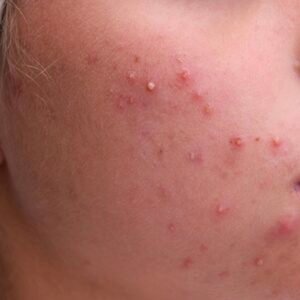 | EARLY SIGNS OF SERIOUS ILLNESS