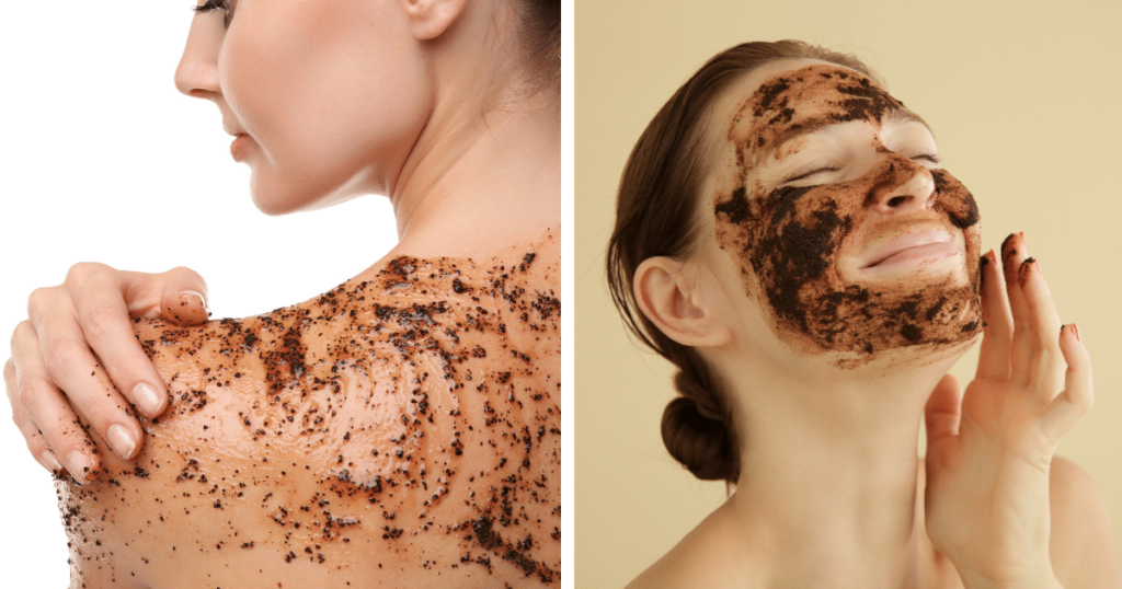 Body Acne: 10 Tips To Get Rid Of Them