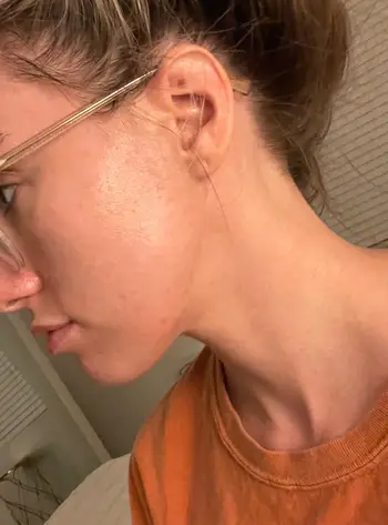 Img 3753