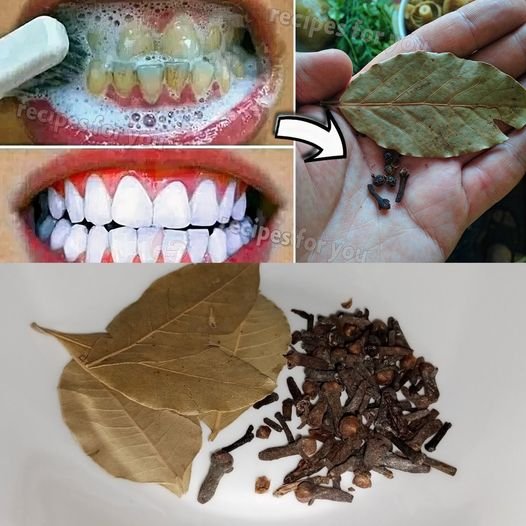 Natural Teeth Whitening with Bay Leaves and Cloves: A Dental Secret