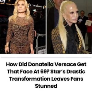Donatella Versace’s new face leaves fans shaken