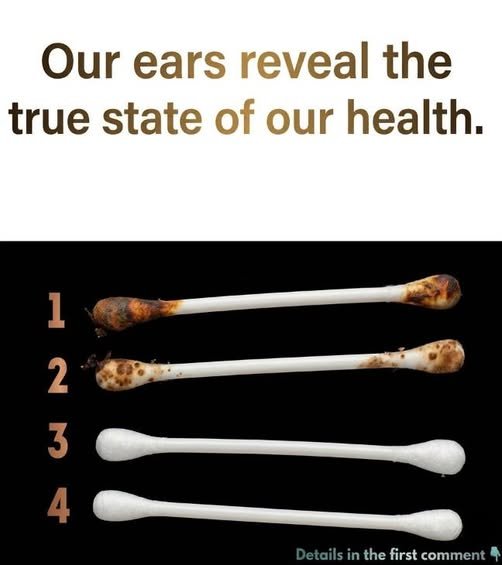 Close-up illustration of different earwax colors and textures showing common variations in ear health.