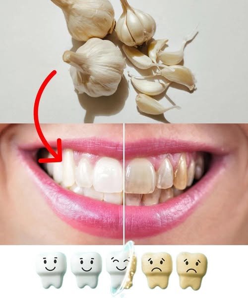 Fresh garlic cloves used as natural remedy for oral health and gum care